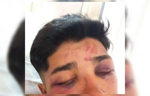 El padre del joven golpeado en Don Victorio apuntó contra la policía
