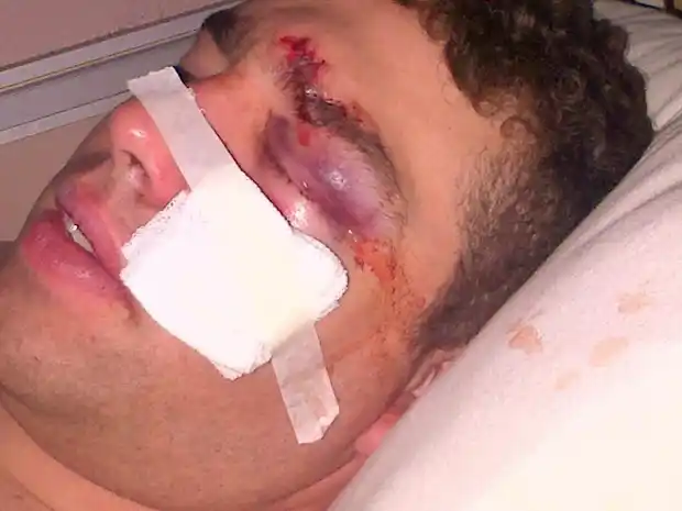 Por ser umbandista, lo golpearon salvajemente y lo enviaron al hospital