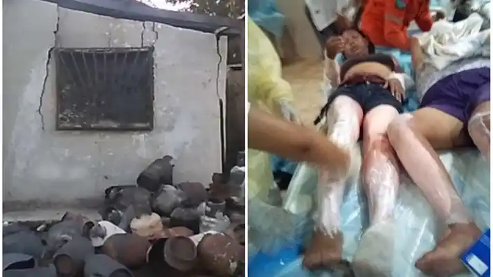 AGONIZÓ 21 DÍAS: muere quinta víctima de la explosión en Monagas