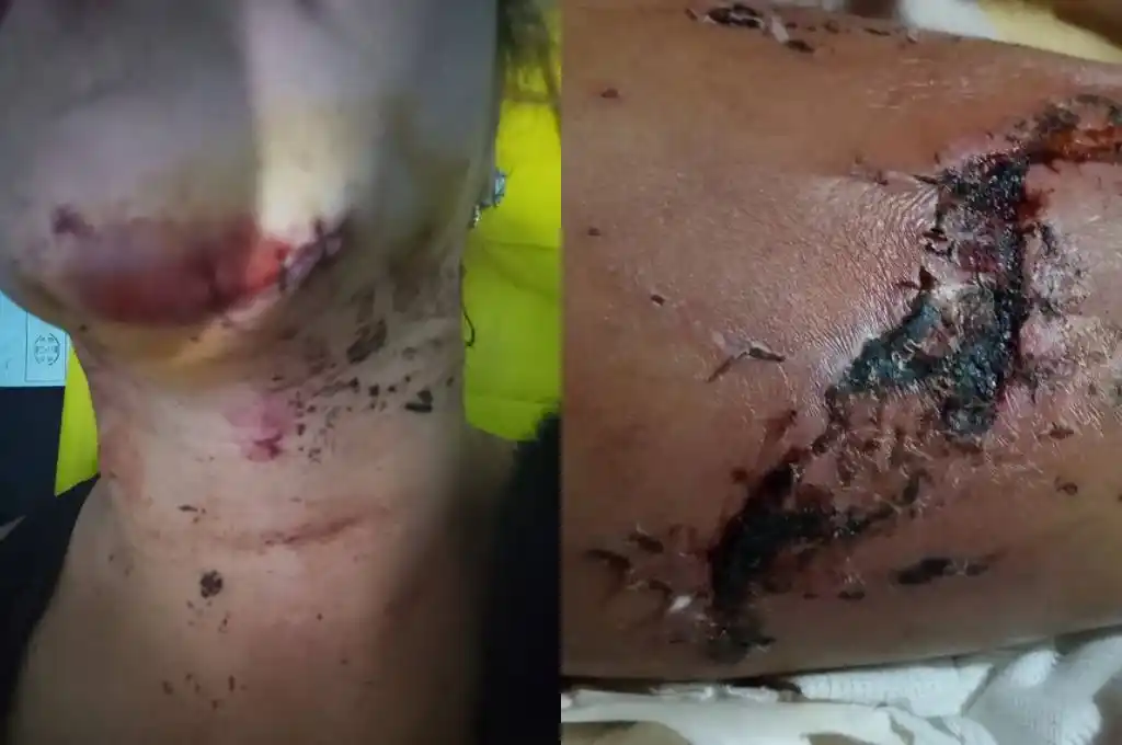 Motociclista atropellada