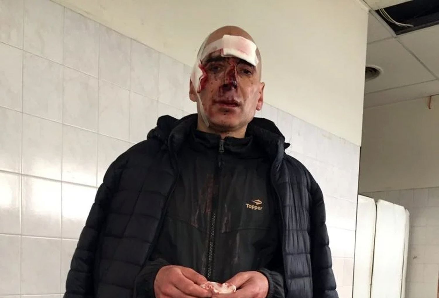 Dos motociclistas atacaron salvajemente a un runner en la costa