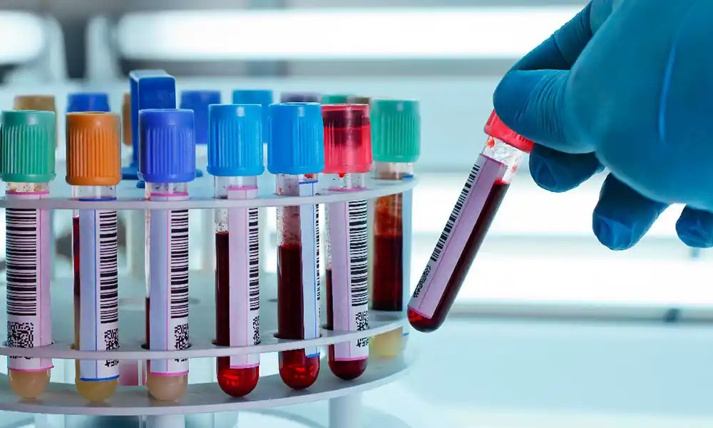 Los bioquímicos cobrarán copagos de al menos 3.000 pesos a los usuarios de prepagas