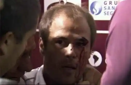Video: Un plateísta le partió la cara a un jugador de Lanús 