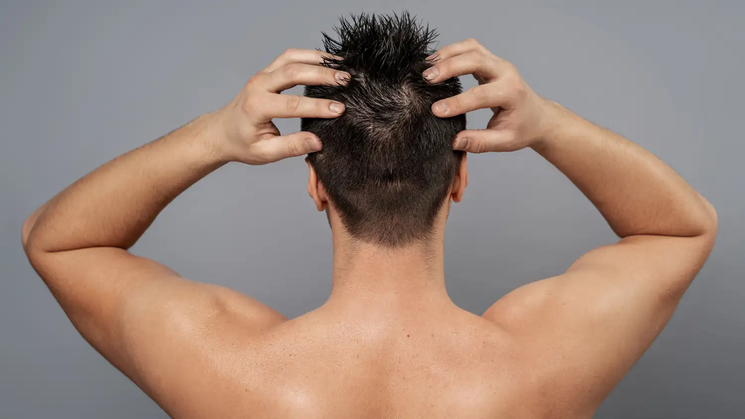 El pelo que no vuelve: alopecia y trasplante capilar en jóvenes