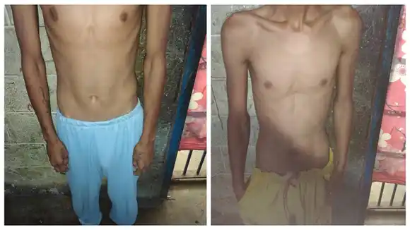 ¡DESNUTRIDOS! La lamentable situación en que se encuentran los presos de Uribana