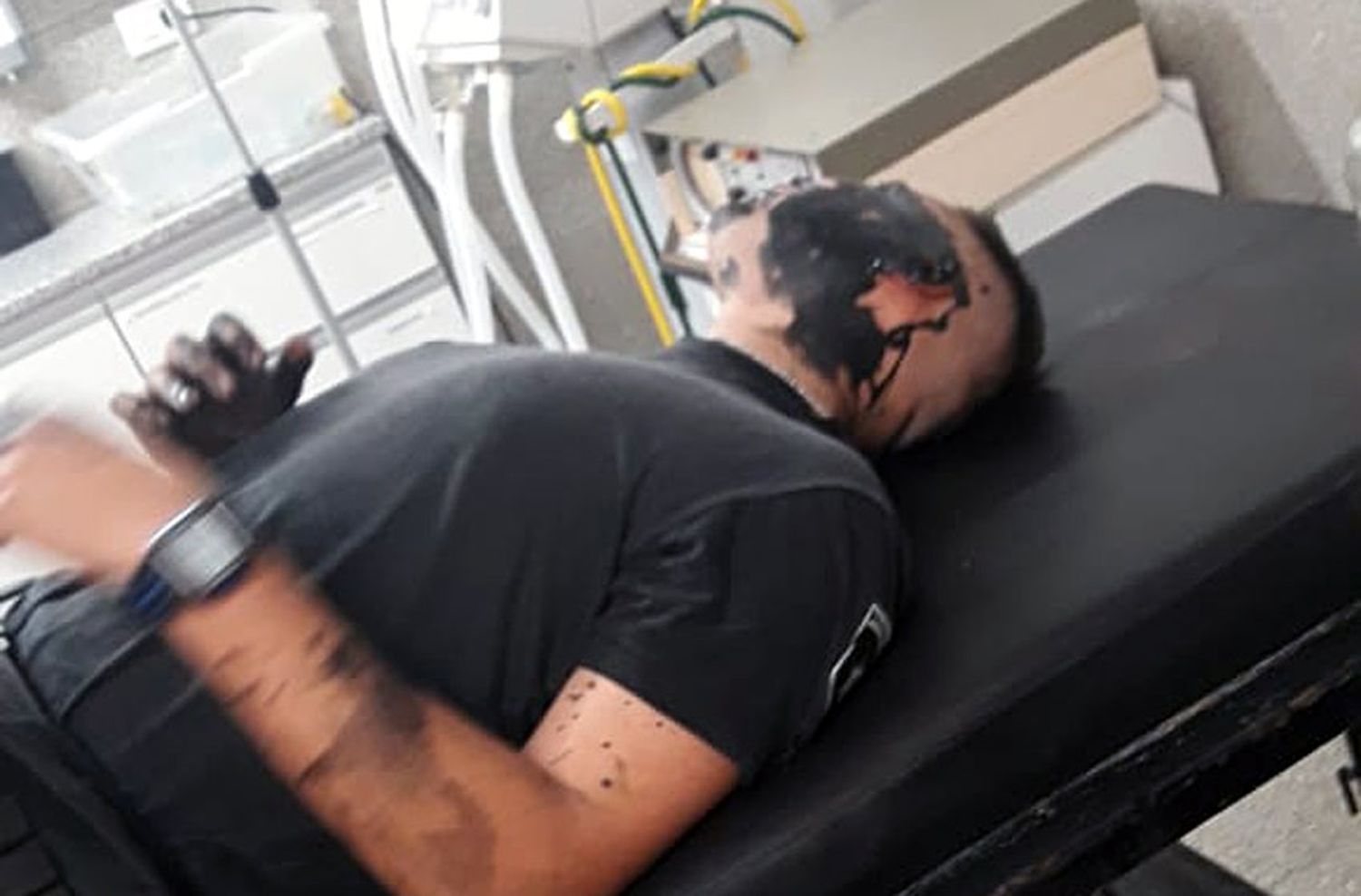 Lo fueron a detener por violencia doméstica y le tiró brea caliente a un policía