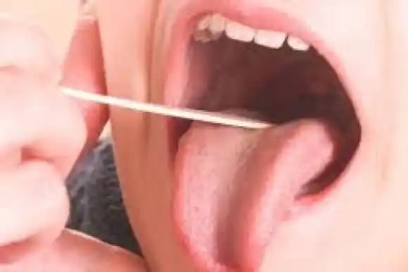 Sonia Martorano: "El Streptococcus pyogenes existe desde siempre"