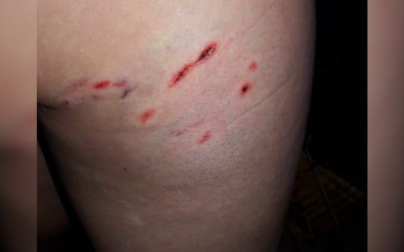 Perro mordió a una mujer en Novillo, entre Salta y Pellegrini
