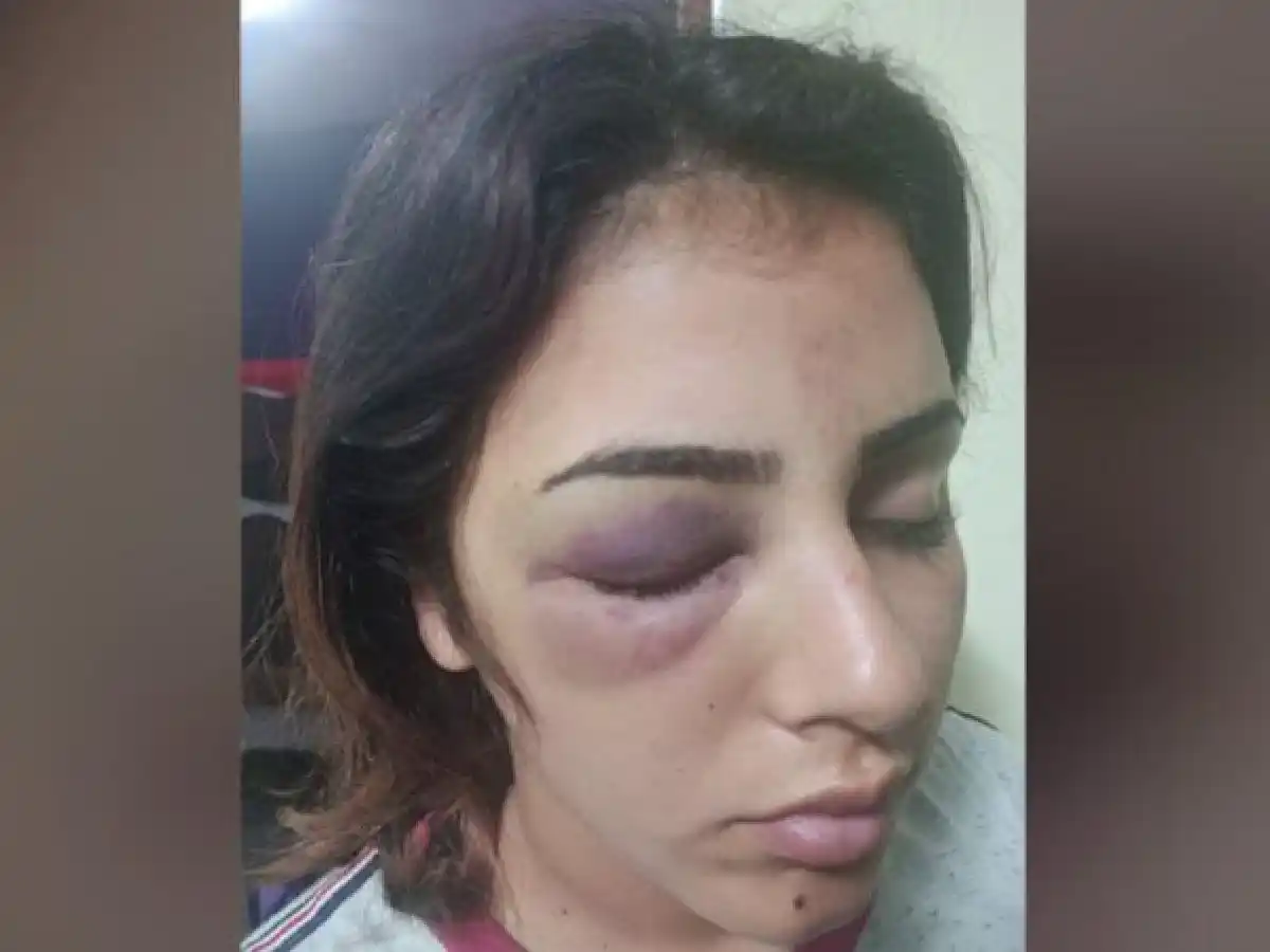 Imputan por lesiones graves a dos de las tres presuntas agresoras de joven en Arroyito