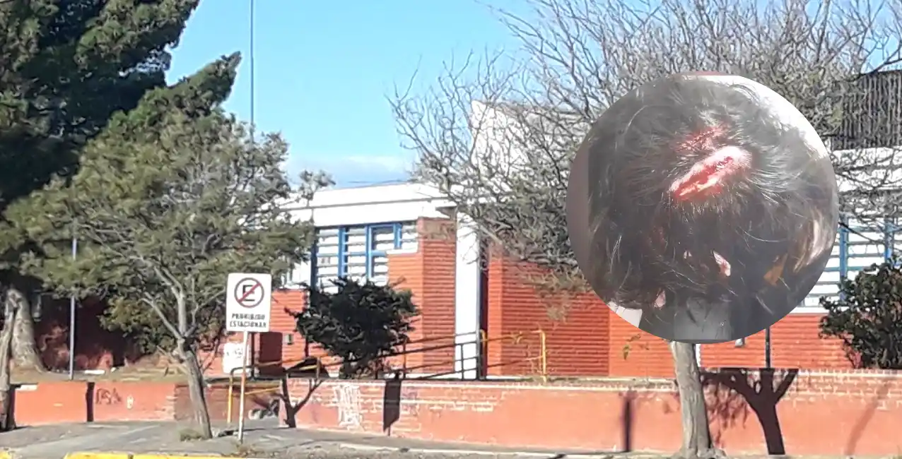 El agresor había solicitado ir al baño y volvió al aula para pegarle.