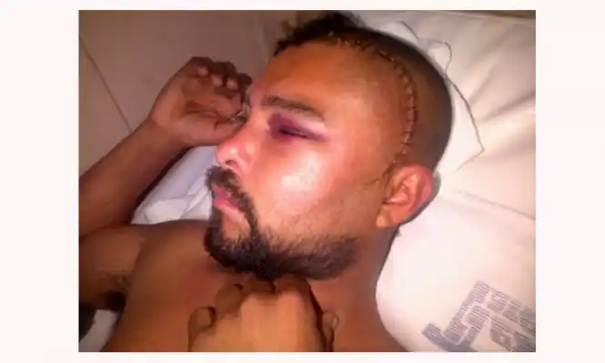 Pilar: Brutal golpiza lo dejó sin habla 