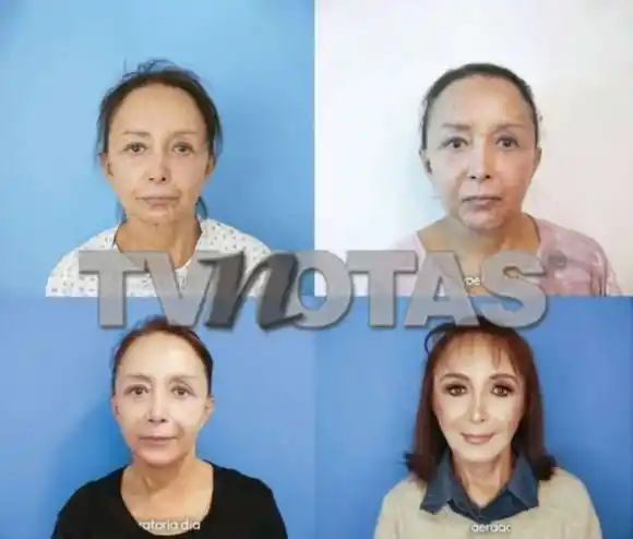 El antes y el después de María Antonieta de las Nieves.