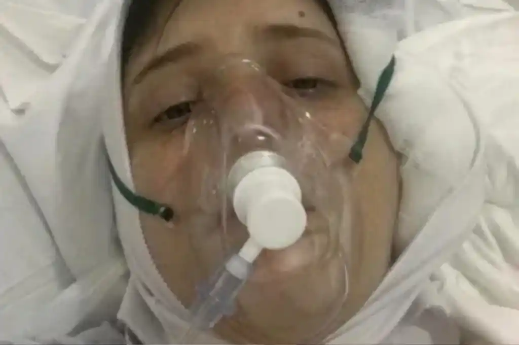 Se dislocó la mandíbula intentando comer una hamburguesa