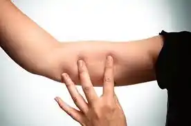 Presentaron anticonceptivo subdérmico para adolescentes 