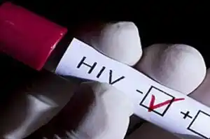 Se incrementaron los casos de HIV en Mendoza