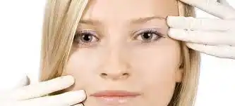 Marcas faciales