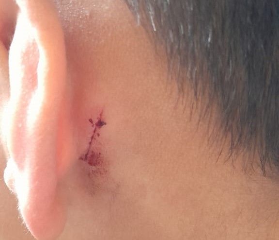 Violencia en la escuela: tras el pedido de ayuda de la mamá, hubo reunión con autoridades para volver a clases