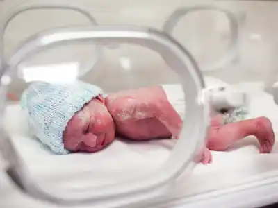 Preocupa que los padres interrumpan los controles médicos de los bebés prematuros