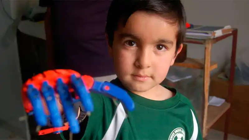 Aunque no sabía de ortopedia, pudo fabricar la prótesis para su hijo