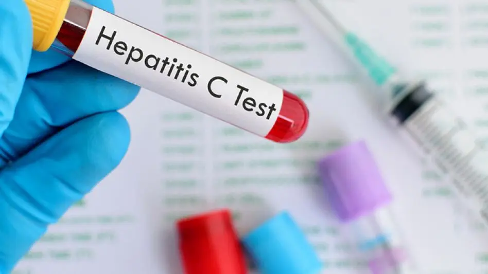 Campaña de Detección Gratuita de Hepatitis C frente a la Catedral
