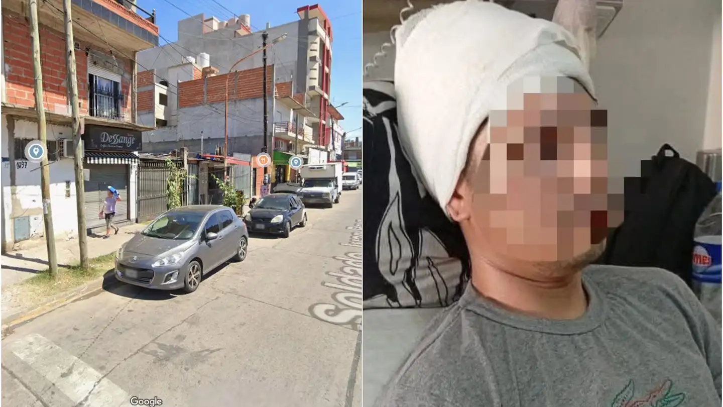 El episodio terminó con la víctima internada de urgencia y operada por una fractura de cráneo.