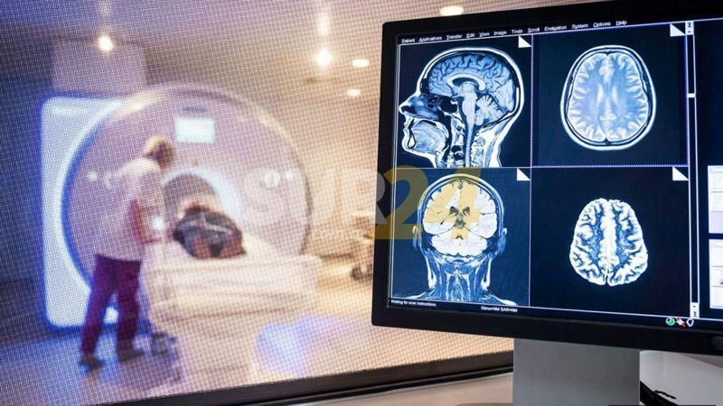Detectan secuelas cognitivas a largo plazo en personas que tuvieron Covid