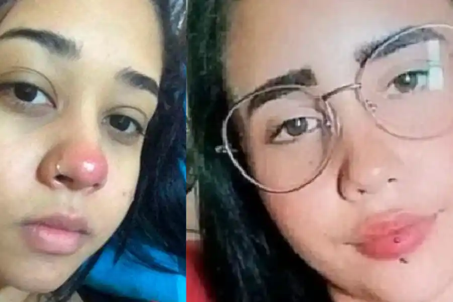 Una muerte y un caso de paraplejia tras perforaciones de piercing en el rostro: ¿qué sucedió?