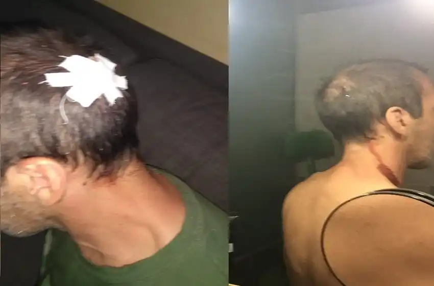 Lo golpearon para robarle en zona noroeste, denunció que «nunca llegó un patrullero» y apuntó contra Sain