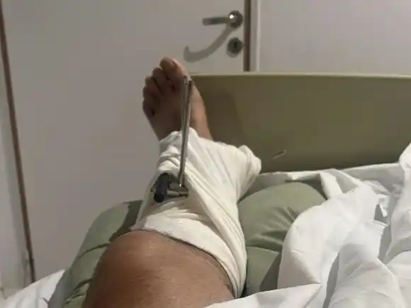 Cómo se encuentra el concejal baleado en Olavarría: "esperando los estudios prequirúrgicos para operarme de nuevo"