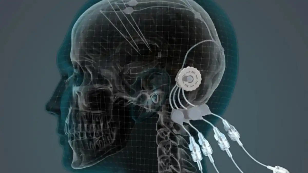 La estimulación cerebral, esperanza para las lesiones de médula espinal