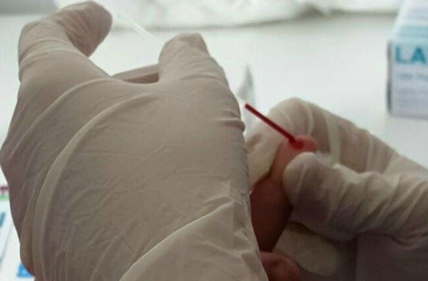 Día Nacional de la Prueba del VIH: en Mar del Plata, hay 1200 personas en tratamiento