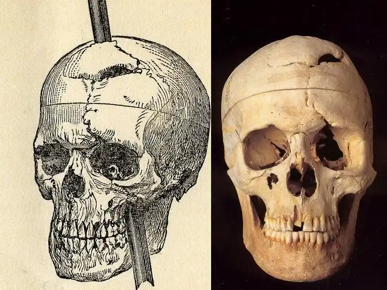 Relación mente cerebro - El caso de Phineas Gage