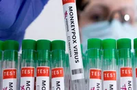 La OMS aconsejó no emitir una alerta sanitaria mundial por viruela del mono