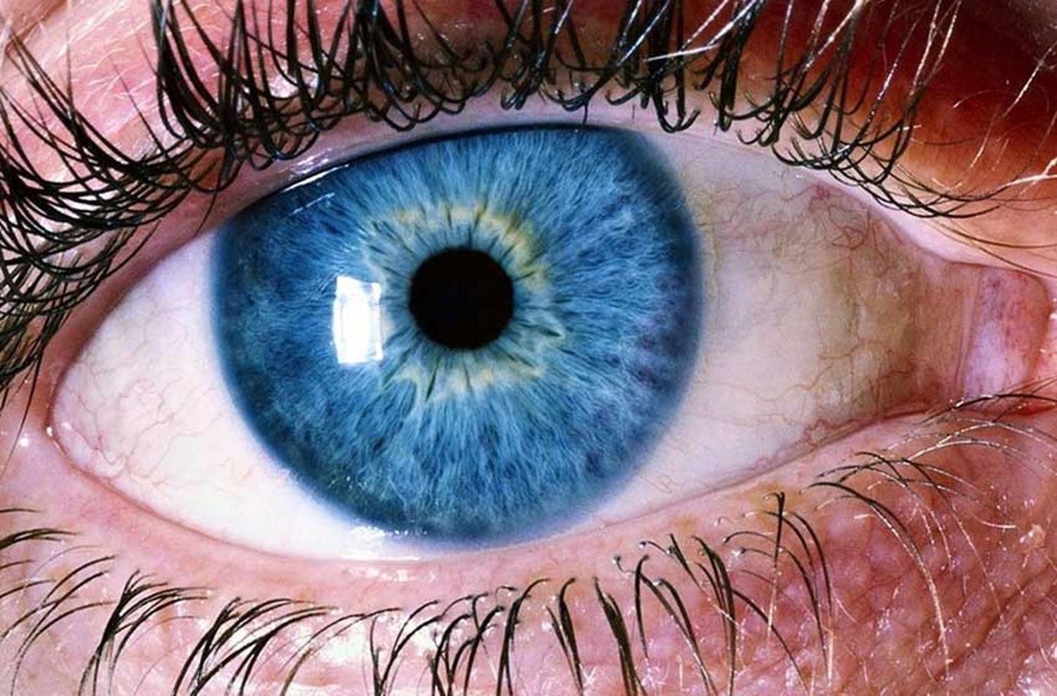 Brasileñas importan semen de estadounidenses blancos y de ojos celestes