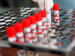 Coronavirus: 2 positivos, 50 negativos y 56 casos activos