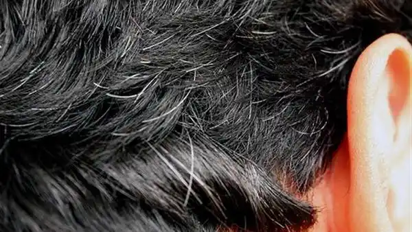 Guerra a las canas: qué alimentos las combaten