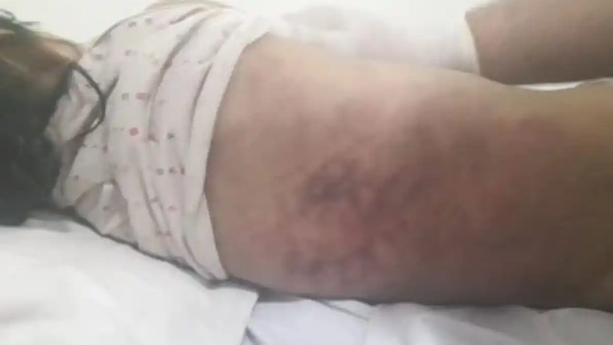 LE DESPRENDIÓ EL CORAZÓN: hombre mató a golpes a su hijastra de 1 año y 4 meses por defecar sobre él