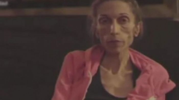 El video de una mujer anoréxica que tiene 37 años y pesa 20 kilos conmociona a la red