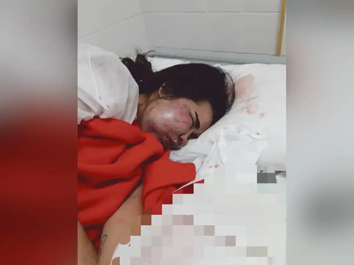 Prisión preventiva para el joven que le desfiguró el rostro a una mujer en San Jorge