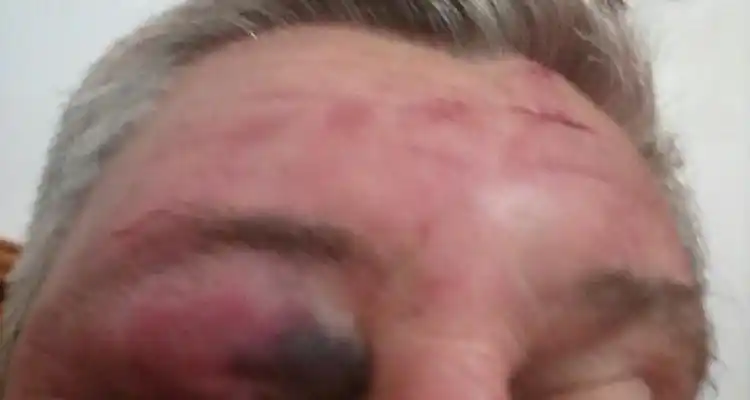 Habló el hombre golpeado en la calle por un exconvicto: “Me dijo que me iba a matar”