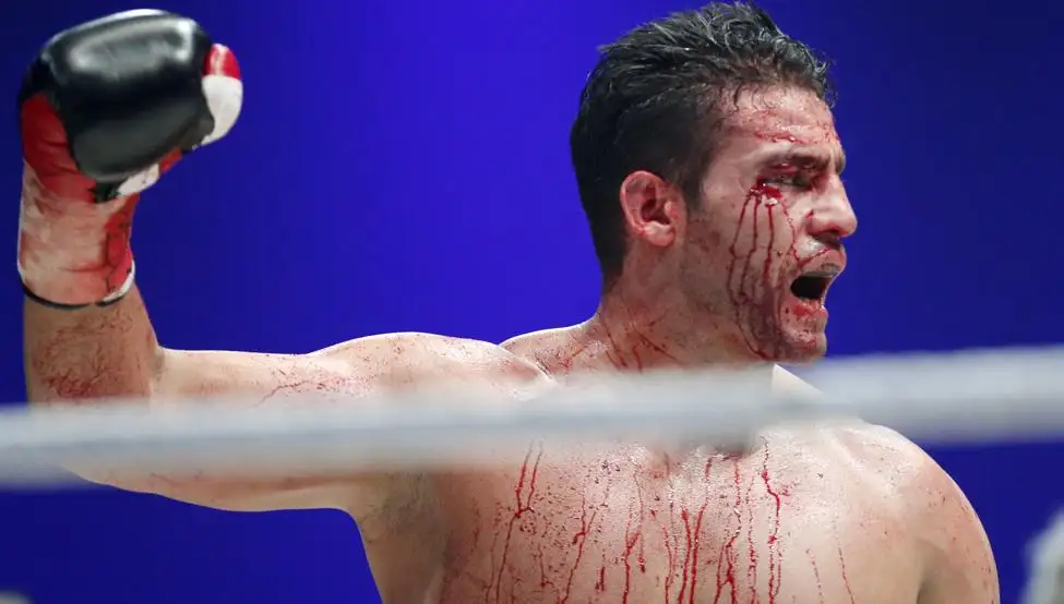Doping positivo del campeón pesado AMB