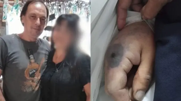 Un bonaerense fue picado por una araña y murió: Denuncian mala praxis
