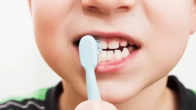 Siete de cada diez personas tienen caries en la Argentina.