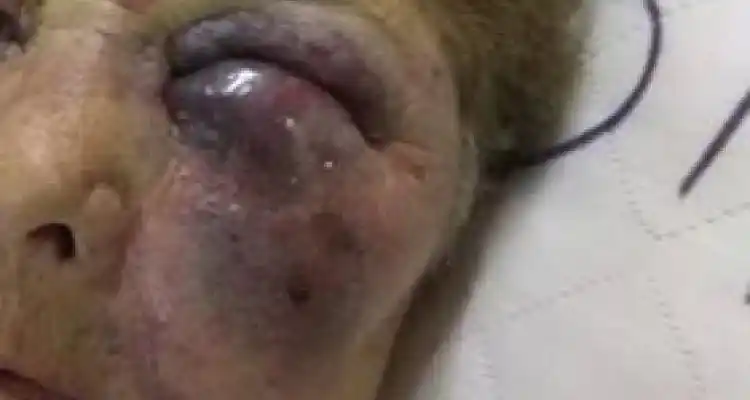 Menor con frondosos antecedentes golpeó salvajemente a una abuela para robarle