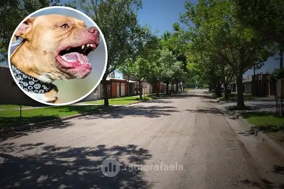 Un pitbull mordió a una menor de 8 años en Rafaela: tuvo que ser trasladada al Hospital