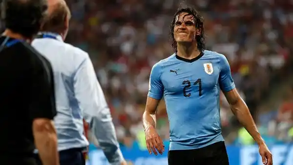Cavani no jugará ante Francia