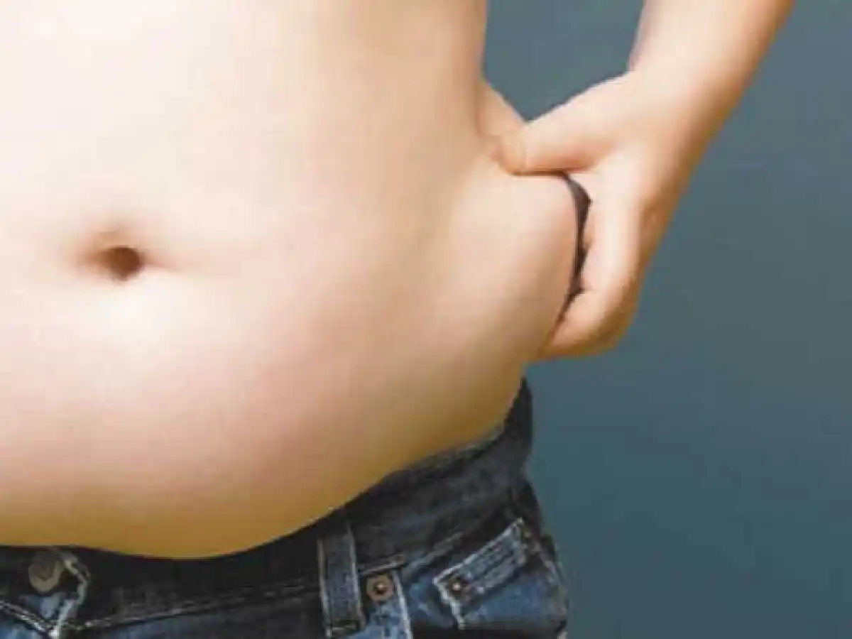  Llaman a cambiar la  mirada sobre el abordaje  de la obesidad 