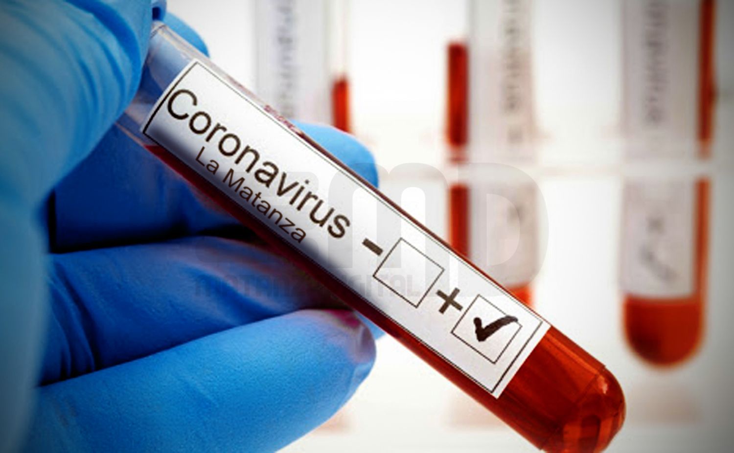 Coronavirus: La Matanza quedó cerca de la barrera de los 600 casos positivos y registró una nueva muerte