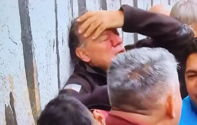 "Pongo la cara y lo que tenga que poner, yo no me escondo", dijo Berni mientras era agredido a trompadas