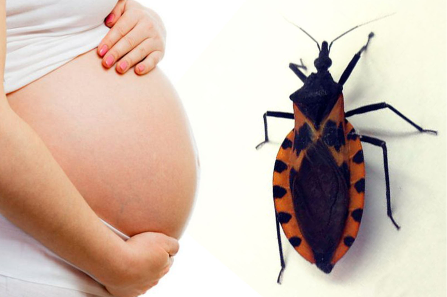 En el país, cada año nacen entre 1.200 y 1.300 bebés con Chagas congénito.